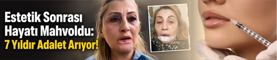 Estetik Sonrası Hayatı Mahvoldu: 7 Yıldır Adalet Arıyor!