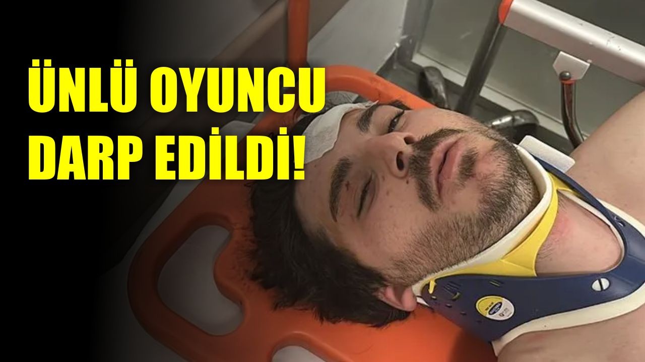Ünlü Oyuncu Öldüresiye Darp Edildi!