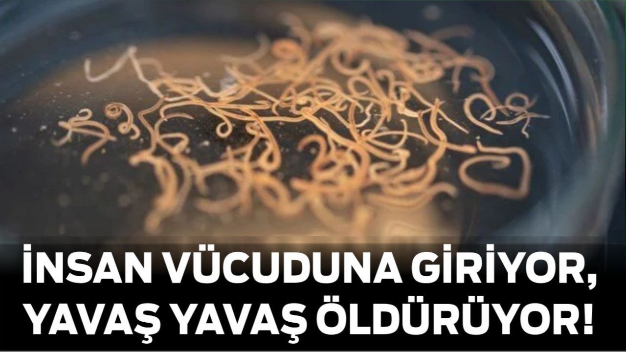 İnsan Vücuduna Giriyor, Yavaş Yavaş Öldürüyor!