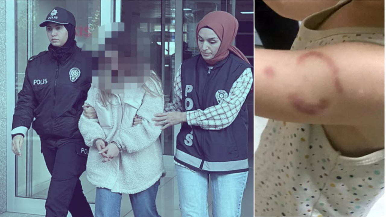3 Yaşındaki Öğrencisini Isıran Öğretmen Tutuklandı!