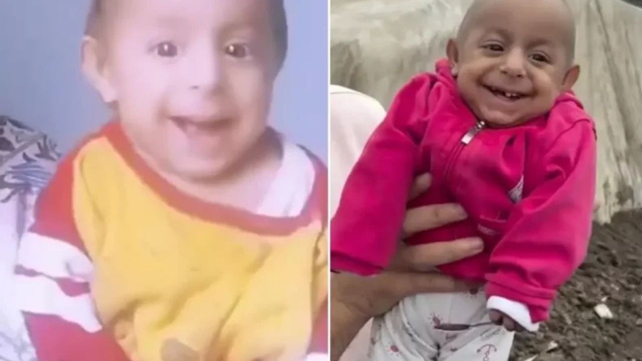 Gülen Bebek Ökkeş Kimdir, Kaç Yaşında, Nereli? Gerçek İsmi Ne?