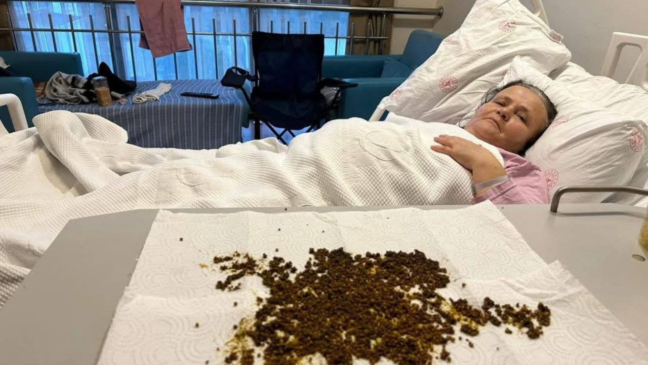 Soma’da 70 Yaşındaki Kadının Safra Kesesinden 20 Bin Taş Çıkarıldı