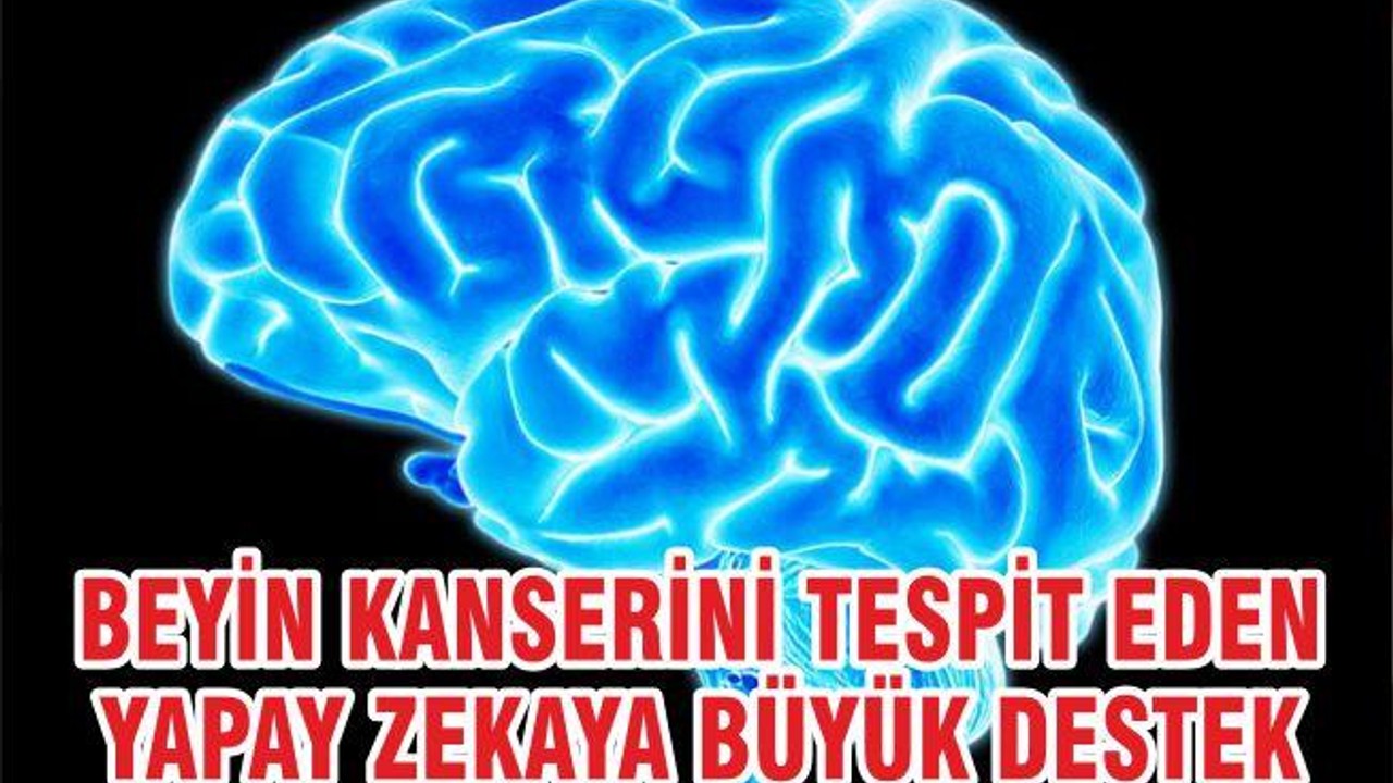 Beyin Kanserini Tespit Eden Yapay Zekaya Büyük Destek