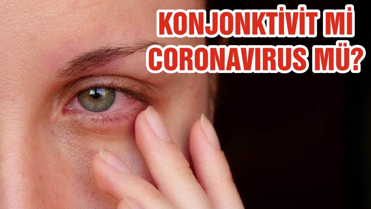 KONJONKTİVİT Mİ CORONAVIRUS MÜ?