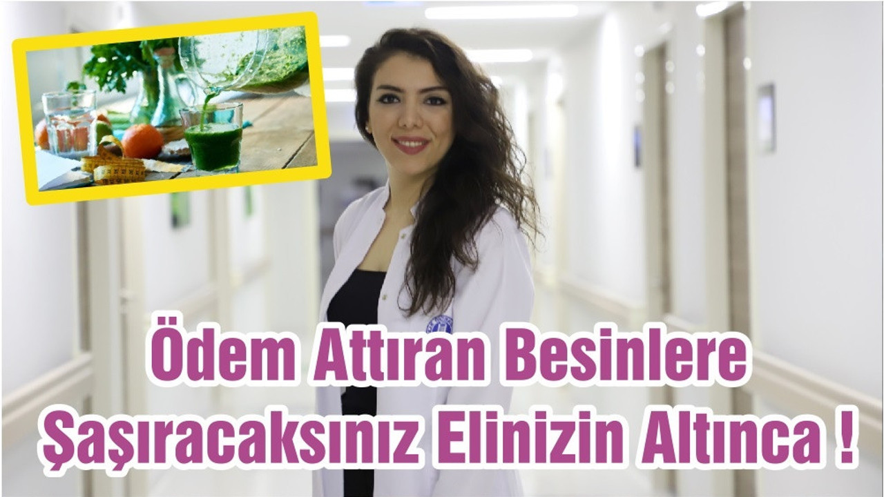 Ödem Attıran Besinlere Şaşıracaksınız Elinizin Altınca !