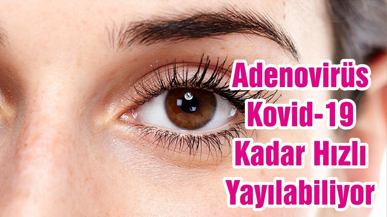 Adenovirüs Kovid-19 Kadar Hızlı Yayılabiliyor