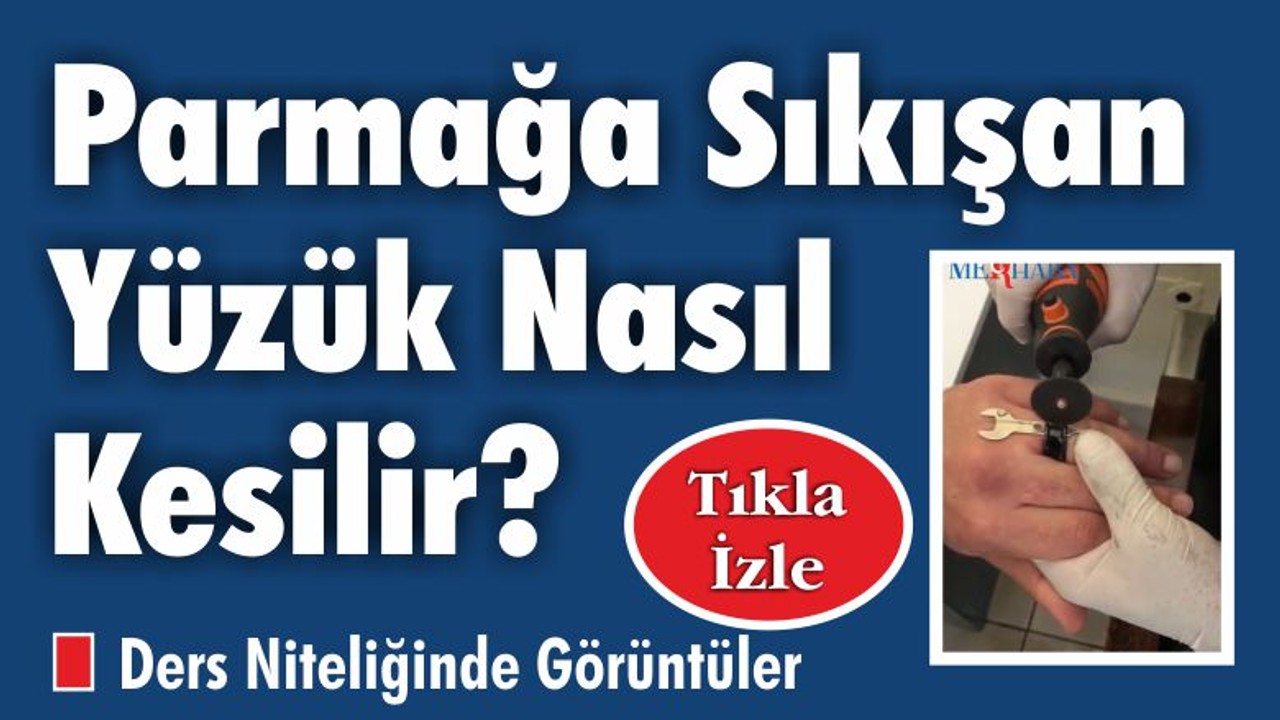 Parmağa Sıkışan Yüzük Nasıl Kesilir?