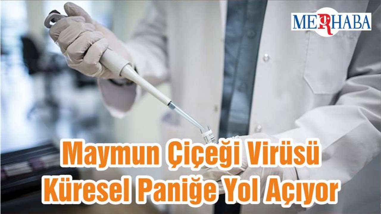 Maymun Çiçeği Virüsü Küresel Paniğe Yol Açıyor