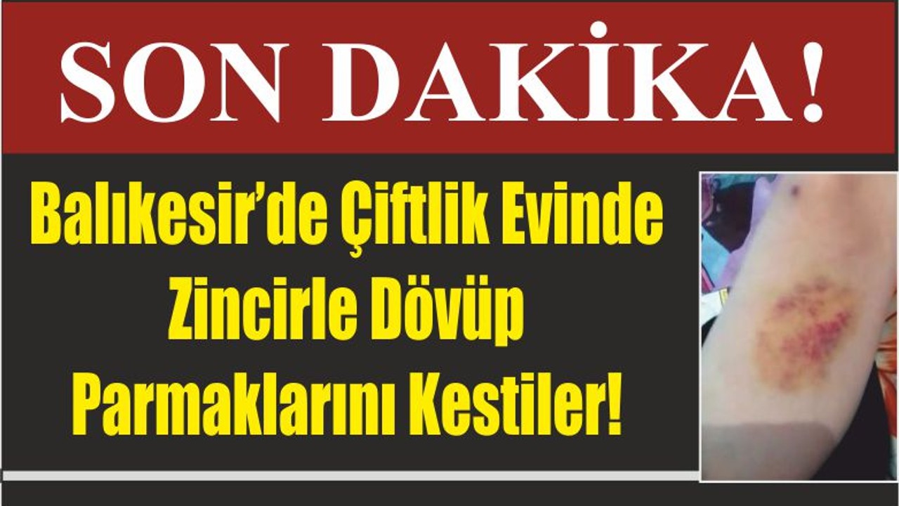 Balıkesir’de Çiftlik Evinde Zincirle Dövüp Parmaklarını Kestiler!