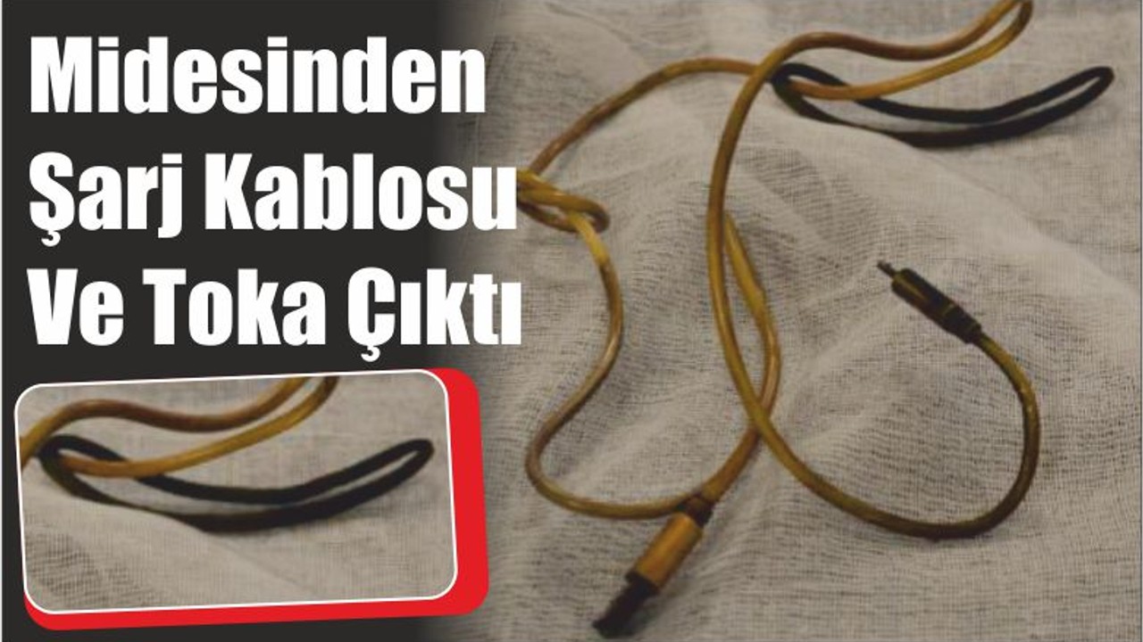 Midesinden Şarj Kablosu Ve Toka Çıktı