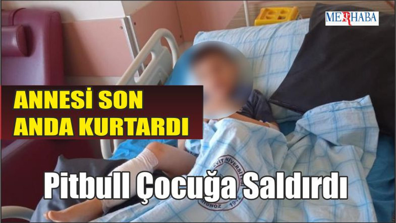 Pitbull Çocuğa Saldırdı