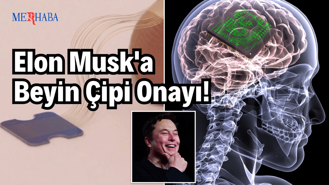 Musk'a Beyin Çipi Onayı!