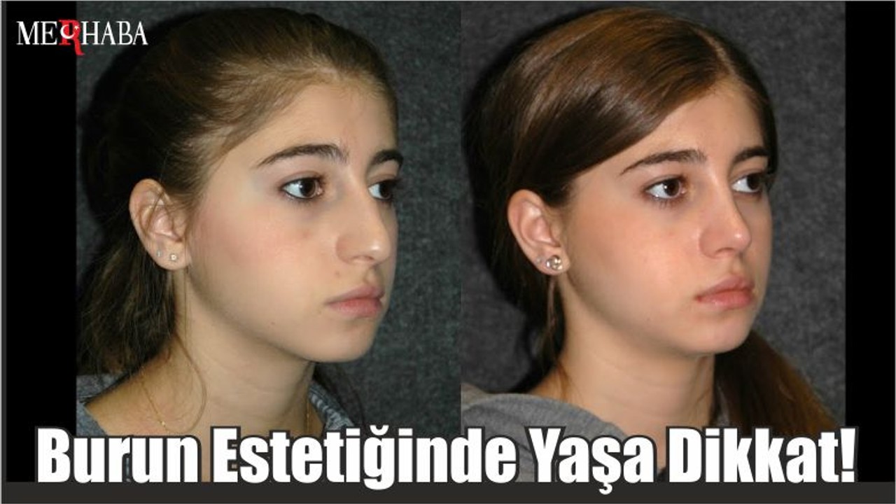 Burun Estetiğinde Yaşa Dikkat!