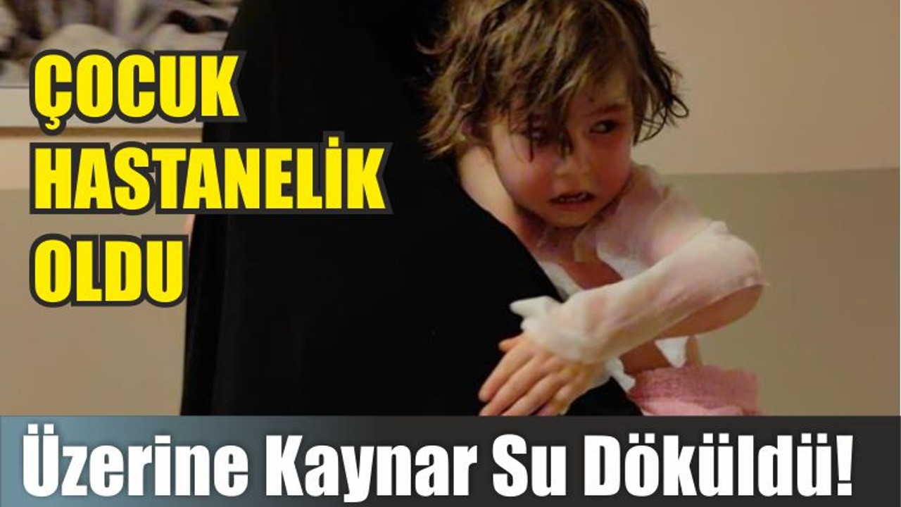Üzerine Kaynar Su Döküldü! Çocuk Hastanelik Oldu