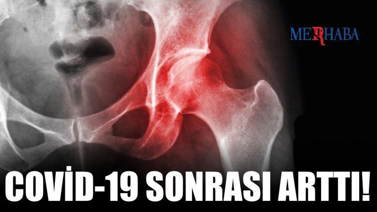 Covid-19 Sonrası Artış Gösterdi!