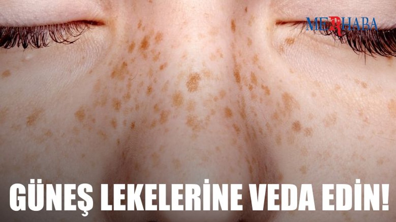 Güneş Lekelerine Veda Edin
