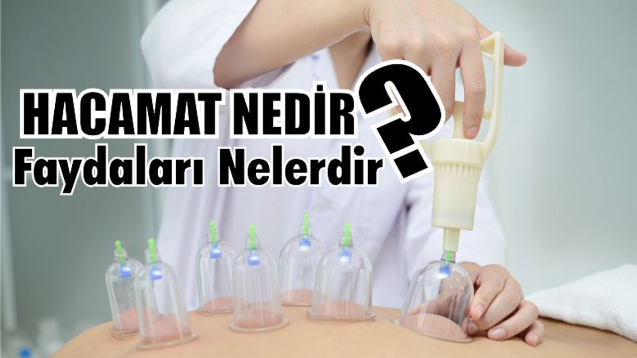 Hacamat Faydaları Nedir?