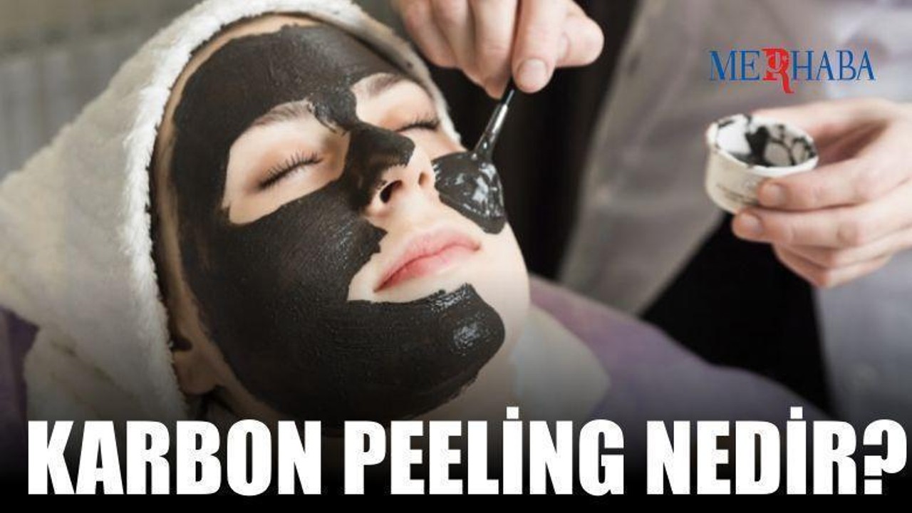 Karbon Peeling Nedir?