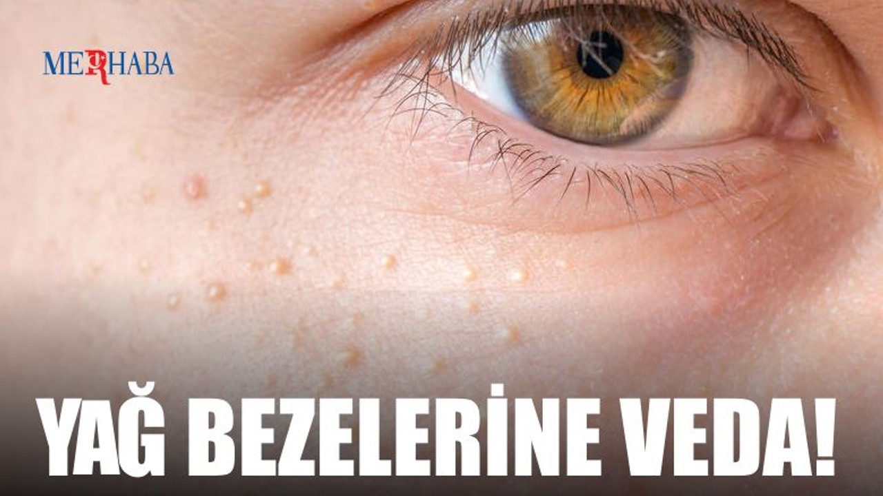 Yüzdeki Yağ Bezelerine Veda!