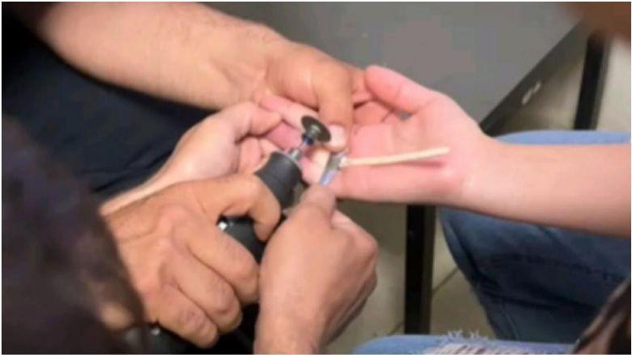 Parmakları Şişince telefona koştu