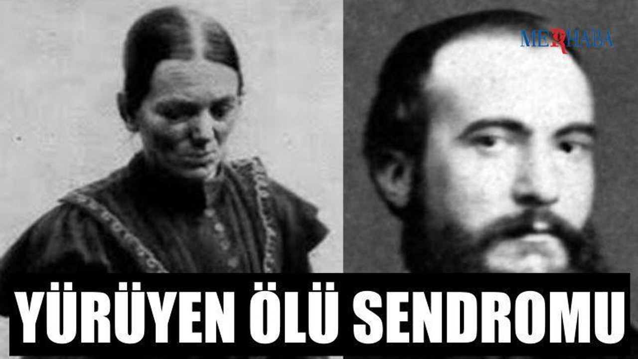 Yürüyen Ölü Sendromu