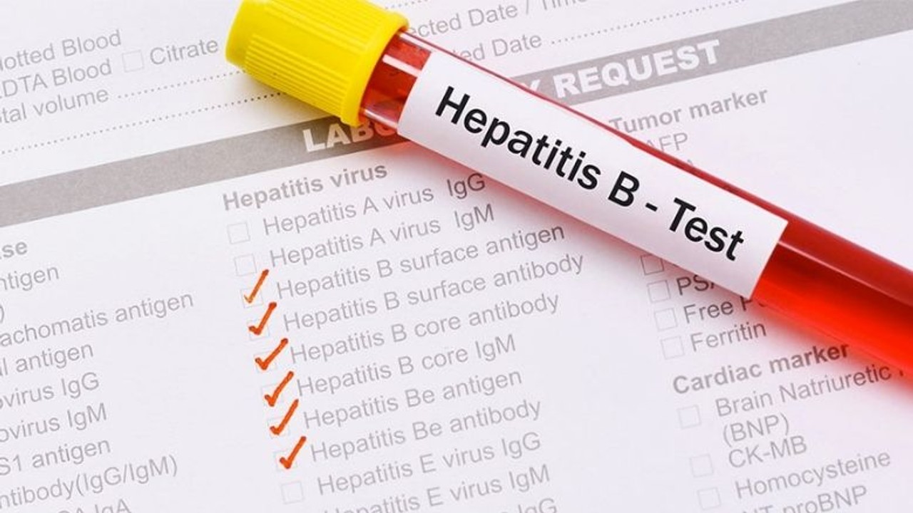 Hepatit Beklemez!