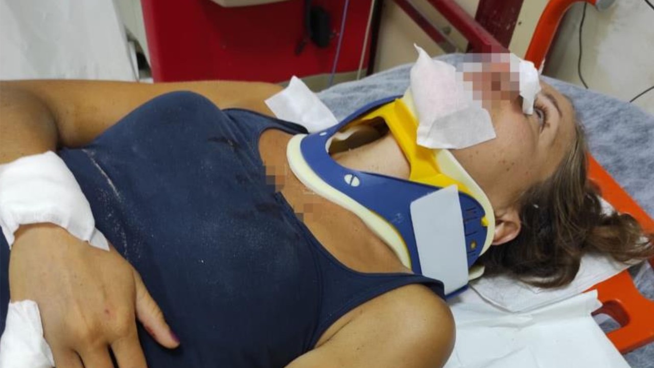 Balıkesir'de Korkunç Olay ! Scooterdan Düştü Ardından Köpekler Saldırdı
