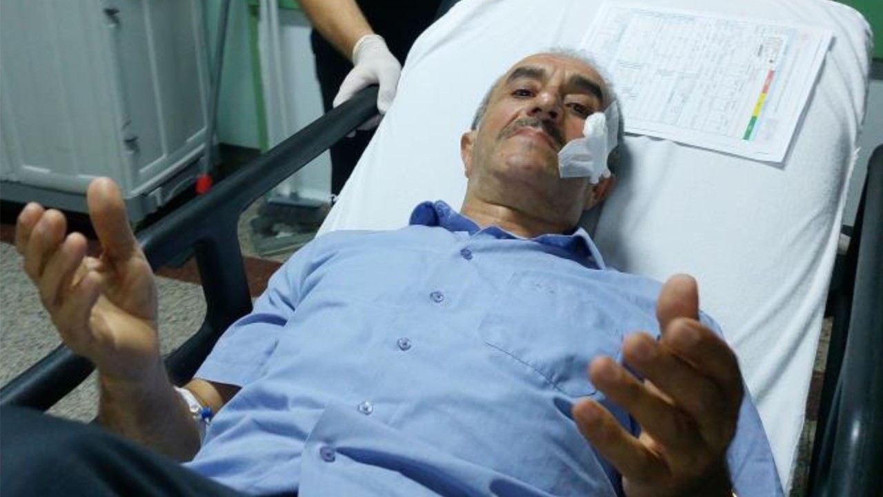 Maganda Kurşunuyla Yüzünden Vuruldu