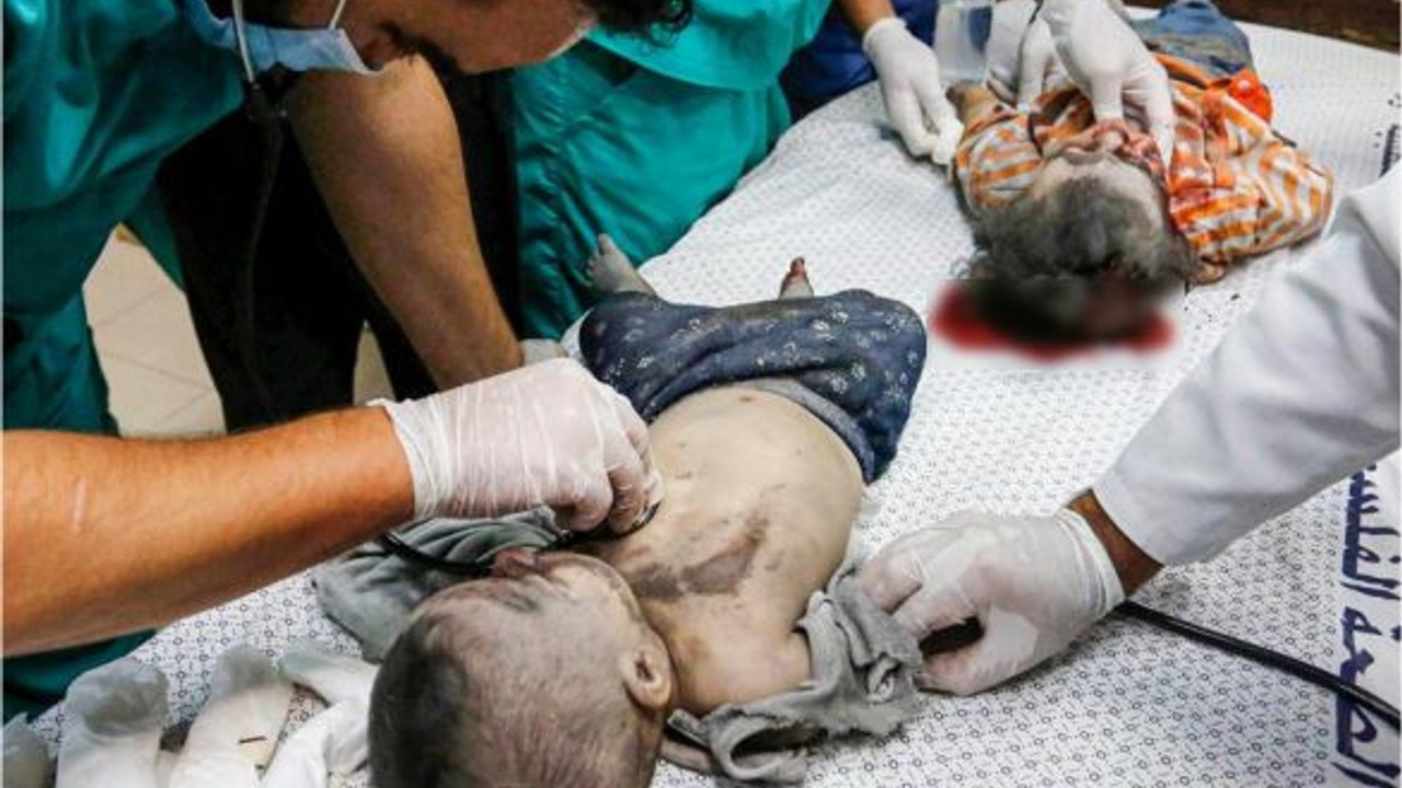Gazze'de Dezenfektan Tükendi! Doktorlar Sıra Dışı Çözüm Buldu