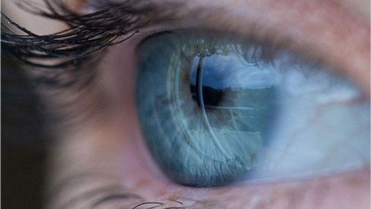 Katarakt Nedir? Belirtileri ve Tedavi Yöntemleri