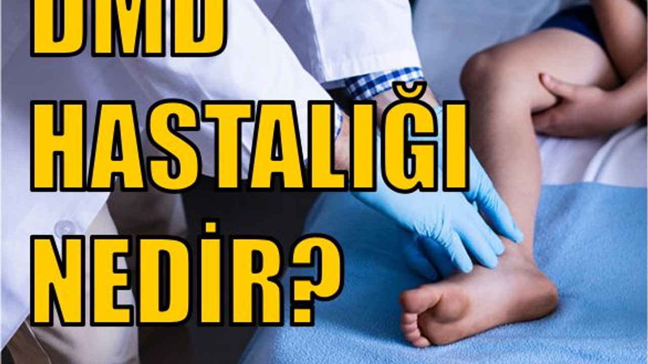 DMD Kas Hastalığı Nedir?