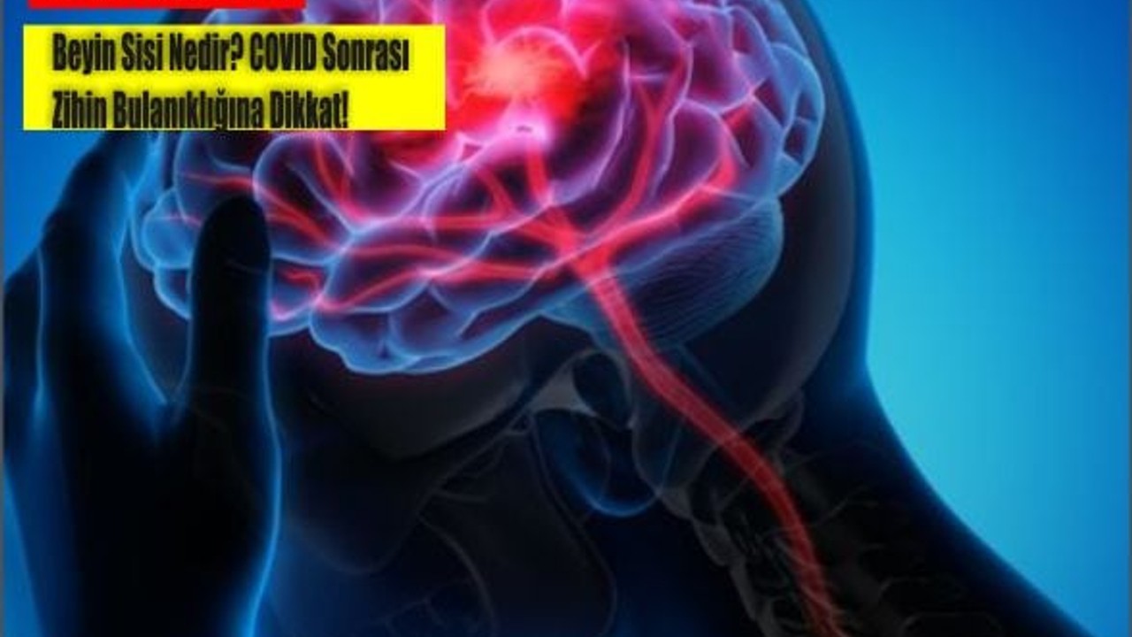 Beyin Sisi Nedir? COVID Sonrası Zihin Bulanıklığına Dikkat!