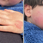 Kreşte Şok Olay! 2,5 Yaşındaki Çocuğa Darp İddiası