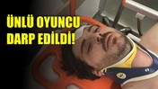 Ünlü Oyuncu Öldüresiye Darp Edildi!