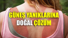 Balıkesir’de Güneş Yanıklarına Doğal Çözüm