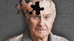 Alzheimer tedavisinde ilaç umudu