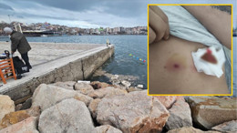 Balıkesir Bandırma’da Havalı Tüfek Kazası: 1 Kişi Hastanede