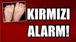 KIRMIZI ALARM!