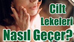 Cilt Lekeleri Nasıl Geçer? Karbon Peeling Uygulaması Nedir?