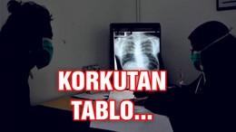 Dünyada her gün yaklaşık 4 bin 500 kişi veremden ölüyor