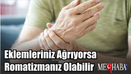 Eklemleriniz Ağrıyorsa Romatizmanız Olabilir