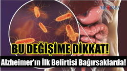 Alzheimer'ın İlk Belirtisi Bağırsaklarda!
