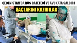 Çeçenistan'da Rus Gazeteci Ve Avukata Saldırı