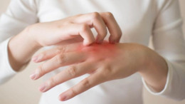 Deri Döküntüsü Hakkında Her Şey!