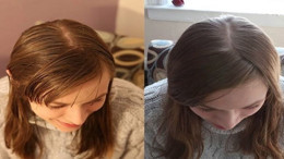 Saçlarınızı Doğal Yollarla Arındırın: No Poo Akımı