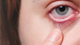 Kışın Artan Göz Enfeksiyonlarına Dikkat