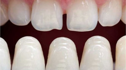 Gülümsemenizden Memnun Musunuz?