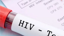 1 Aralık Dünya AIDS Günü