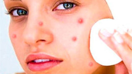 Fesleğen ile Cilt Bakımı