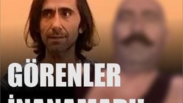 Son Halini Görenler Tanıyamadı!